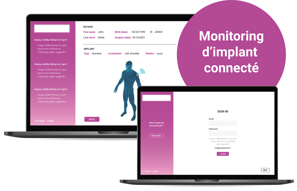 Plateforme IoT Médicale_Monitoring d'implant connecté
